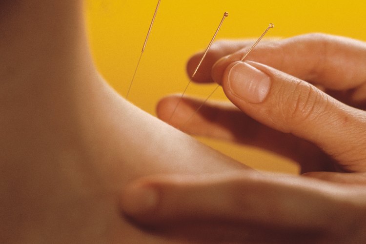 Acupuncture needle being removed from neck.